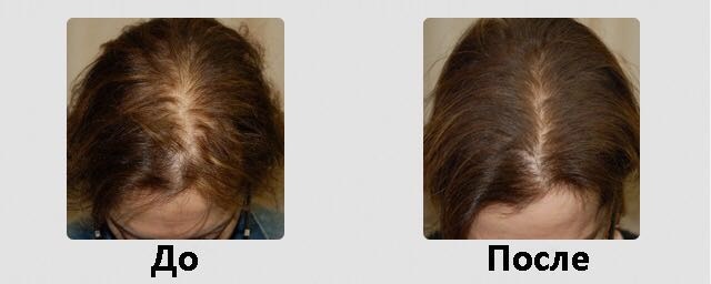 Восстановление волос